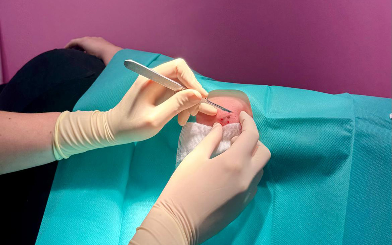 ambulantes Operieren