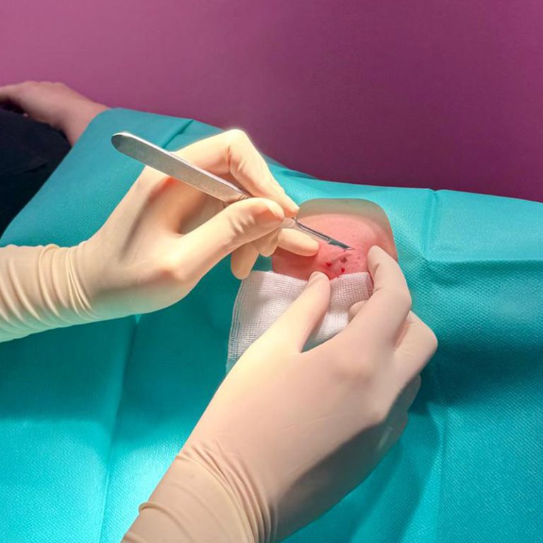 ambulantes Operieren